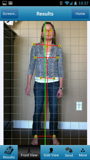 Posture Screen is integrated into Genesis Chiropractic Software.