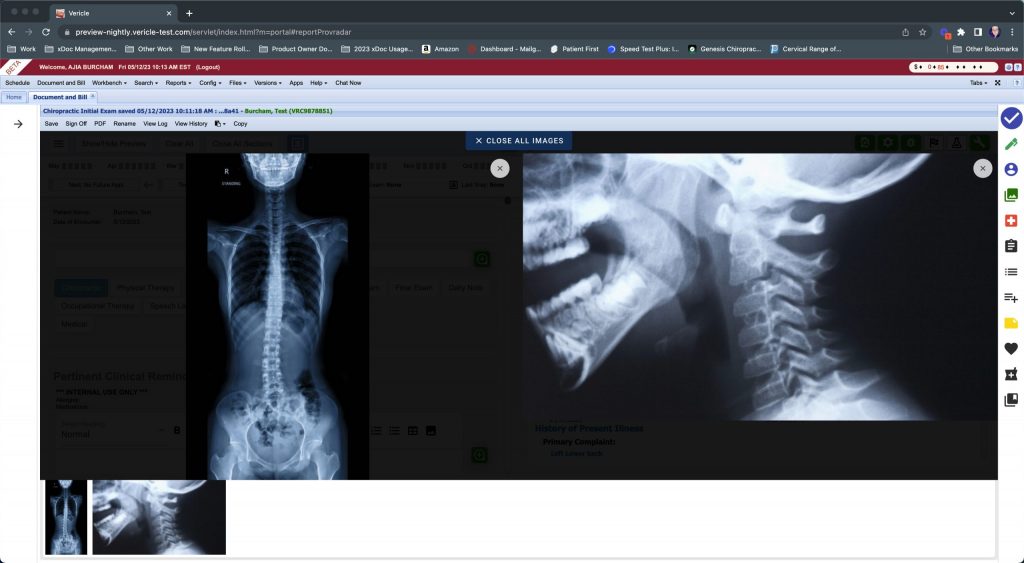 Screenshot demonstrating the zoom functionality of the Integrated X-Ray Viewing feature in Genesis Chiropractic Software, showing a detailed, zoomed-in view of a specific X-ray image.